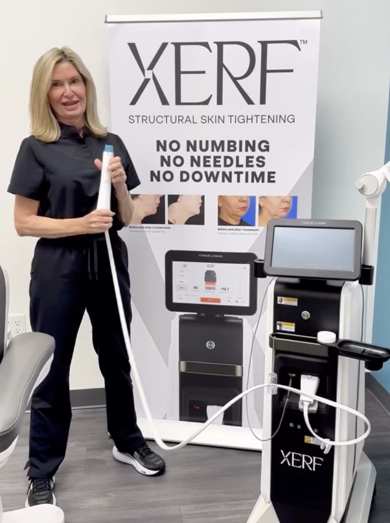 Renuance provider with the XERF skin tightening device