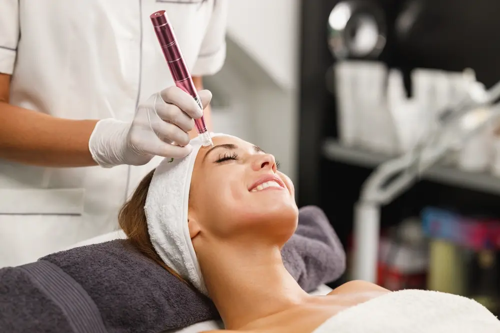 Morpheus8 RF microneedling treatment at Renuance