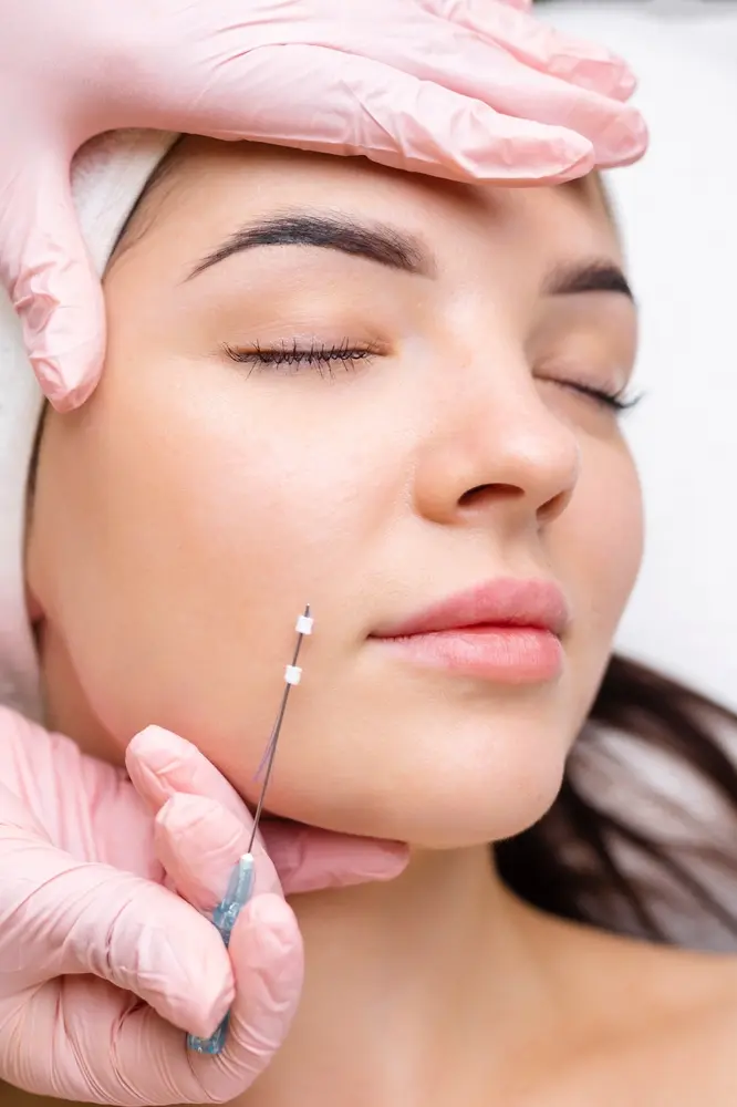 NovaThreads thread lift at Renuance Murrieta